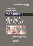 Campbell Ortopedia Operacyjna Tom 4