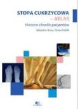 Stopa cukrzycowa - atlas. Historie chorób pacjentów