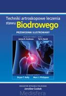 G-techniki-artroskopowe-leczenia-stawu-biodrowego-przewodnik-ilustrowany_10601_150x190