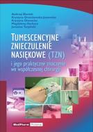 G-tumescencyjne-znieczulenie-nasiekowe-tzn-i-jego-praktyczne-znaczenie-we-wspolczesnej-chirurgii_3010_150x190