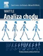 G-whittle-analiza-chodu_12455_150x190