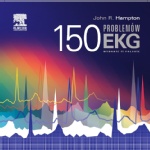 150 problemów EKG
