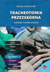 Tracheotomia przezskórna Podstawy techniki strategie