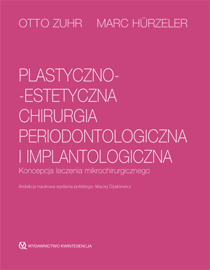 Plastyczno-estetyczna chirurgia periodontologiczna i implantologiczna Koncepcja leczenia mikrochirurgicznego