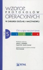Wzorce protokołów operacyjnych w chirurgii ogólnej i naczyniowej Tom 5 Chirurgia naczyniowa