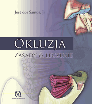 Okluzja Zasady & Leczenie
