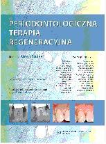 Periodontologiczna terapia regeneracyjna