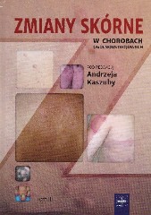 Zmiany skórne w chorobach ogólnoustrojowych Tom 3