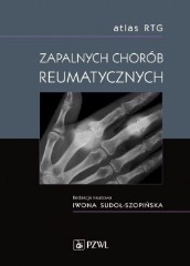 Atlas RTG zapalnych chorób reumatycznych