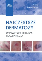 Najczęstsze dermatozy w praktyce lekarza rodzinnego