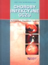 Choroby infekcyjne oczu. Kompendium diagnostyki i leczenia.