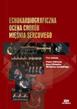 Echokardiograficzna ocena chorób mięśnia sercowego