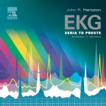 EKG Seria to proste
