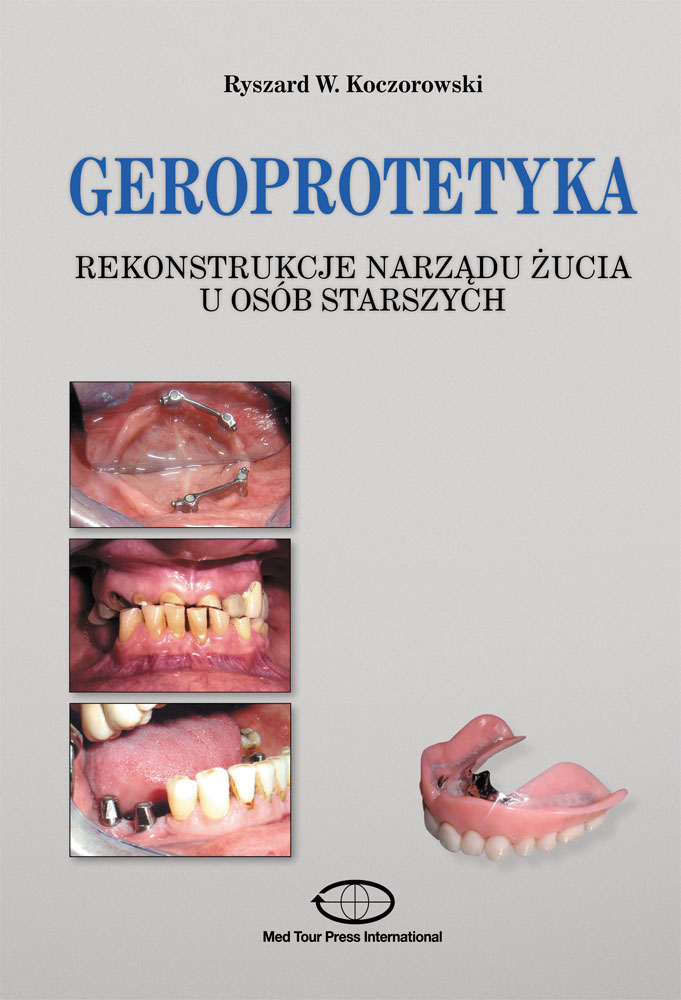 Geroprotetyka Rekonstrukcje narządu żucia u osób starszych