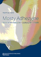 Mosty adhezyjne Minimalnie inwazyjne Estetyczne Trwałe