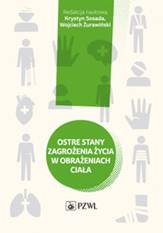Ostre stany zagrożenia życia w obrażeniach ciała