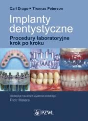 Implanty dentystyczne. Procedury laboratoryjne krok po kroku.