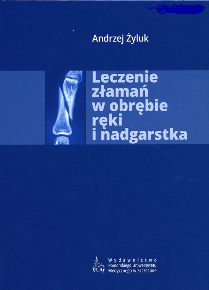 Leczenie złamań w obrębie ręki i nadgarstka
