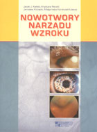 Nowotwory narządu wzroku