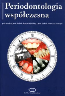 Periodontologia współczesna