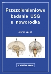 Przezciemieniowe badanie USG u noworodka CD