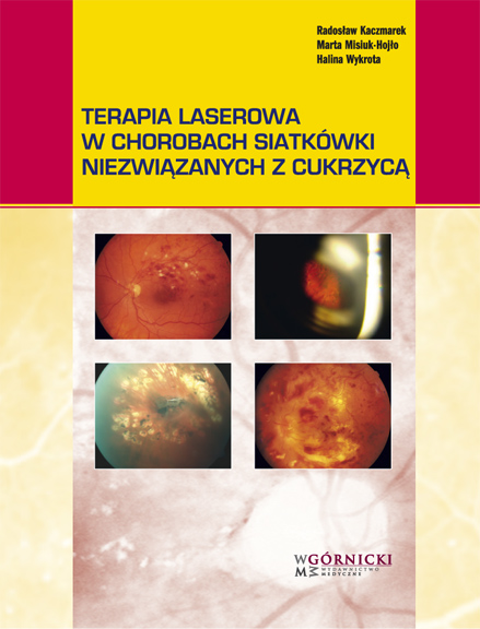 Terapia laserowa w chorobach siatkówki niezwiązanych z cukrzycą