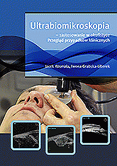 Ultrabiomikroskopia - zastosowanie w okulistyce Przegląd przypadków klinicznych