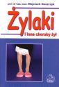 Żylaki i inne choroby żył