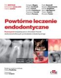 Powtórne leczenie endodontyczne