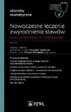 Nowoczesne leczenie zwyrodnienia stawów Mini-interwencje zabiegowe