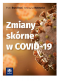 Zmiany skórne w COVID-19