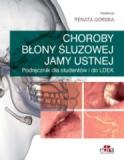 Choroby błony śluzowej jamy ustnej Podręcznik dla studentów i do LDEK