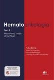 Hematoonkologia Tom 2 Nowotwory układu chłonnego