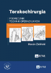 Torakochirurgia Podręcznik technik operacyjnych
