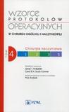 Wzorce protokołów operacyjnych w chirurgii ogólnej i naczyniowej Tom 4 Chirurgia naczyniowa