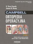 Campbell Ortopedia Operacyjna Tom 1