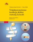 Trójpłaszczyznowa terapia skolioz Oddechowo-ortopedyczny system według Schroth