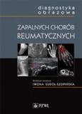 Diagnostyka obrazowa zapalnych chorób reumatycznych