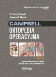 Campbell Ortopedia Operacyjna Tom 3