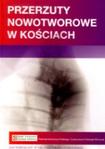 Przerzuty nowotworowe w kościach