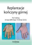 Replantacje kończyny górnej