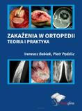 Zakażenia w ortopedii - teoria i praktyka