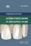 Stomatologia estetyczna. Licówki porcelanowe na zęby żuchwy i szczęki