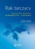 Rak tarczycy Aktualne metody diagnostyki i leczenia