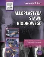 G-alloplastyka-stawu-biodrowego-dorr_6026_150x190
