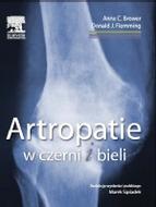 G-artropatie-w-czerni-i-bieli_11903_150x190