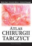 Atlas Chirurgii Tarczycy