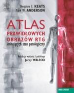 G-atlas-prawidlowych-obrazow-rtg-imitujacych-stan-patologiczny_5369_150x190