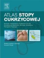 G-atlas-stopy-cukrzycowej_10488_150x190