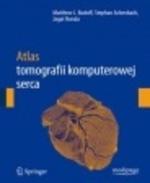 G-atlas-tomografii-komputerowej-serca_4871_150x190